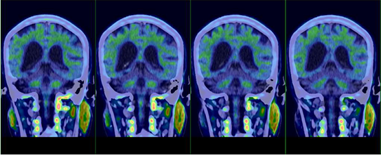 圖片關(guān)鍵詞